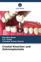 Nivedita Bawa, Chandan Kumar Kusum, S P Singh, S. P. Singh - Crestal-Knochen und Zahnimplantate