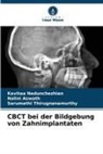 Nalini Aswath, Kavitaa Nedunchezhian, Thirugnanamu, Sarumathi Thirugnanamurthy - CBCT bei der Bildgebung von Zahnimplantaten