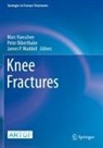 Peter Biberthaler, Marc Hanschen, James P Waddell, James P. Waddell - Knee Fractures