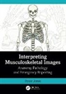 Rosie Jones, Rosie (Uni Hospitals of North Midlands) Jones, Jones Rosie - Interpreting Musculoskeletal Images