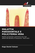 Hugo Daniel Salazar - MALATTIA PARODONTALE E POLICITEMIA VERA