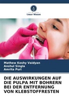 Mathew Koshy Vaidyan, Amrita Puri, Anshul Singla - DIE AUSWIRKUNGEN AUF DIE PULPA MIT BOHRERN BEI DER ENTFERNUNG VON KLEBSTOFFRESTEN