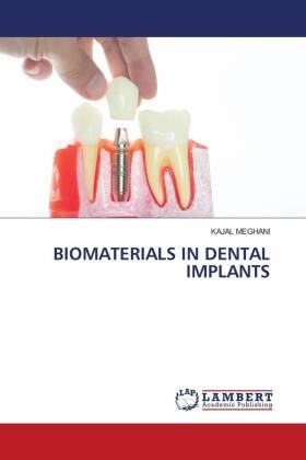 KAJAL MEGHANI - BIOMATERIALS IN DENTAL IMPLANTS - DE
