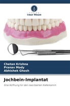 Abhishek Ghosh, Chetan Krishna, Pranav Mody - Jochbein-Implantat