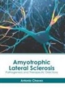 Antonio Chavez - Amyotrophic Lateral Sclerosis: Pathogenesis and Therapeutic Directions