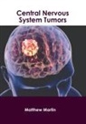 Matthew Martin - Central Nervous System Tumors