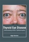 Edgar Harrison - Thyroid Eye Disease: Understanding Graves' Ophthalmopathy