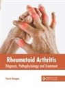 Travis Reagan - Rheumatoid Arthritis: Diagnosis, Pathophysiology and Treatment