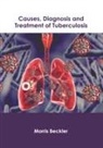 Morris Beckler - Causes, Diagnosis and Treatment of Tuberculosis