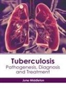 June Middleton - Tuberculosis: Pathogenesis, Diagnosis and Treatment