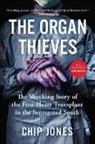 Chip Jones, Chip Jones - The Organ Thieves