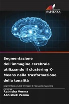 Abhishek Verma, Rajnisha Verma - Segmentazione dell'immagine cerebrale utilizzando il clustering K-Means nella trasformazione della tonalità