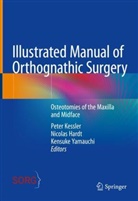 Nicolas Hardt, Peter Kessler, Kensuke Yamauchi - Illustrated Manual of Orthognathic Surgery