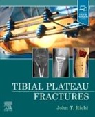 John Riehl - Tibial Plateau Fractures