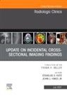 Douglas G Katz, John Hines, Douglas G Katz - Update on Incidental Cross-sectional Imaging Findings, An Issue of Radiologic Clinics of North America