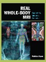 Mathias Goyen, Goyen Mathias - Real Whole-Body MRI: Requirements, Indications, Perspectives