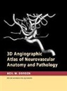 Neil M Borden, Neil M. Borden, Borden Neil M. - 3d Angiographic Atlas of Neurovascular Anatomy and Pathology