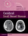 Leonardo Gorelick Pantoni, Philip B Gorelick, Philip B. (College of Human Medicine Gorelick, Gorelick Philip B., Leonardo Pantoni, Pantoni Leonardo - Cerebral Small Vessel Disease