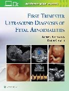Alfred Abuhamad, Alfred Z. Chaoui Abuhamad, Rabih Chaoui - First Trimester Ultrasound Diagnosis of Fetal Abnormalities