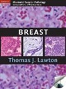 Thomas Lawton, Thomas J. Lawton - Breast