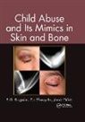B. G. Brogdon, B. G. (Usa (University of South Alabama) Brogdon, B. G. Shwayder Brogdon, Brogdon B. G., Jamie Elifritz, Elifritz Jamie... - Child Abuse and Its Mimics in Skin and Bone