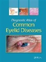 Jonathan J. Dutton, Jonathan J. (University of North Carolina Dutton, Jonathan J. Gayre Dutton, Dutton Jonathan J., Gregg S. Gayre, Gayre Gregg S.... - Diagnostic Atlas of Common Eyelid Diseases