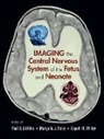 Paul D. (University of Sheffield Griffiths, Paul D. Paley Griffiths, Paul D. Griffiths, Griffiths Paul D., Martyn N.J. Paley, Elspeth H. Whitby... - Imaging the Central Nervous System of the Fetus and Neonate