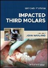 John Wayland, John Wayland - Impacted Third Molars