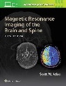 Scott W. Atlas - Magnetic Resonance Imaging of the Brain and Spine