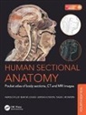 David J. Bowden, David J. (Abdominal Imaging Fellow Bowden, Bowden David J., Adrian Kendal Dixon, Adrian Kendal (Emeritus Professor Dixon, Adrian Kendal Bowden Dixon... - Human Sectional Anatomy