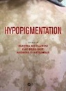 Electra (Andreas Sygros Hospital Nicolaidou, Clio Dessinioti, Dessinioti Clio, Andreas Katsambas, Electra Nicolaidou - Hypopigmentation