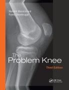 Malcolm Macnicol, Malcolm (Edinburgh Macnicol, Malcolm F MacNicol, Malcolm F. MacNicol, Malcolm Steenbrugge Macnicol, Macnicol Malcolm... - Problem Knee