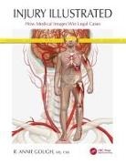 R Annie Gough, R. Annie Gough - Injury Illustrated