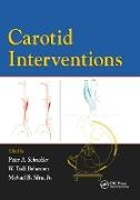 Peter Bohannon Schneider, Todd Bohannon, Bohannon Todd, Peter Schneider, Schneider Peter, … - Carotid Interventions