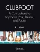 R. L. Mittal, R. L. (Government Medical College and Mitt Mittal - Clubfoot
