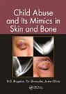 B. G. Brogdon, B. G. (Usa (University of South Alabama) Brogdon, B. G. Shwayder Brogdon, Brogdon B. G., Jamie Elifritz, Elifritz Jamie... - Child Abuse and Its Mimics in Skin and Bone