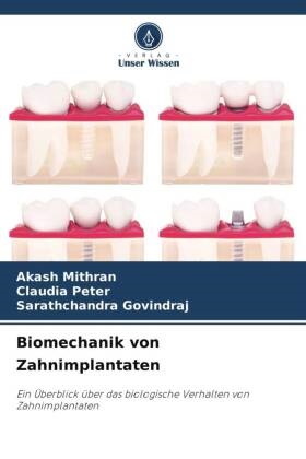 Sarathcha GOVINDRAJ, Sarathchandra GOVINDRAJ, Akash Mithran, Claudia Peter - Biomechanik von Zahnimplantaten Ein Überblick über das biologische Verhalten von Zahnimplantaten. DE