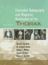 Monvadi B. Srichai, SRICHAI MONVADI B, Glenn A. Krinsky, Nestor L. Muller, Nestor Luiz Muller, David P. Naidich... - Computed Tomography and Magnetic Resonance of the Thorax