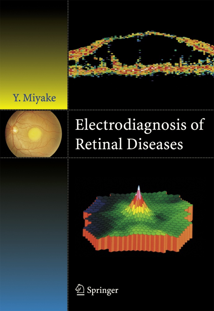 Yozo Miyake - Electrodiagnosis of Retinal Disease