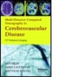 Kenneth (Brighton &amp; Sussex Medical School Miles, Kenneth A. Konig Miles, Kenneth Eastwood Miles, James D. Eastwood, James D. (Duke University Medical Center Eastwood, Eastwood James D.... - Multidetector Computed Tomography in Cerebrovascular Disease