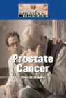 Barbara Sheen - Prostate Cancer
