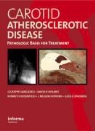 Giuseppe (EDT)/ Holmes Sangiorgi, Guiseppe Spagnoli Sangiorgi, SANGIORGI GUISEPPE SPAGNOLI LUIG, David R. Holmes, L. Nelson Hopkins, Kenneth Rosenfield... - Carotid Atherosclerotic Disease