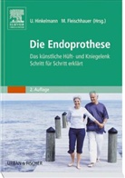 Michael Fleischhauer, Ulrich Hinkelmann - Die Endoprothese