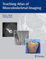 Peter Munk, Peter L. Munk, Anthony G Ryan, Anthony G. Ryan, Peter Munk, … - Teaching Atlas of Musculoskeletal Imaging