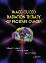 Richard K. (Thomas Jefferson University Valicenti, Richard K. Dicker Valicenti, Richard K. Jaffray Valicenti, Adam P. Dicker, Adam P. (Thomas Jefferson University Dicker, Dicker Adam P.... - Image-Guided Radiation Therapy of Prostate Cancer