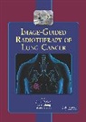 Joe Y. Chang, James D. Cox, James D. (Md Anderson Cancer Center Cox, James D. Chang Cox, James D. Komaki Cox, COX JAMES D KOMAKI RITSUKO U C... - Image-Guided Radiotherapy of Lung Cancer