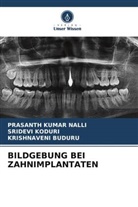 Kris Buduru, Krishnaveni Buduru, Sridevi Koduri, Prasanth Kumar Nalli - BILDGEBUNG BEI ZAHNIMPLANTATEN
