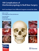 Vinod Felix, Vivek Mariappan, Veerasigamani Narendrakumar - 100 Complications of Otorhinolaryngology & Skull Base Surgery