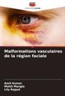 Amit Kumar, Mohit Mangla, Lily Rajput - Malformations vasculaires de la région faciale