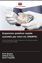 Kirti Banka, Ashish Garg, Amit Tripathi - Expansion palatine rapide assistée par mini-vis (MARPE)